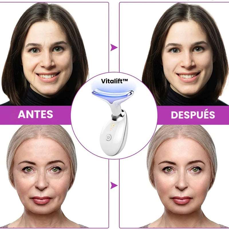 LumiSkin™ - Masajeador Facial Anti Papada con Luz LED! 🌟